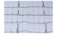 Jakie akcesoria są potrzebne do przeprowadzenia badania EKG?